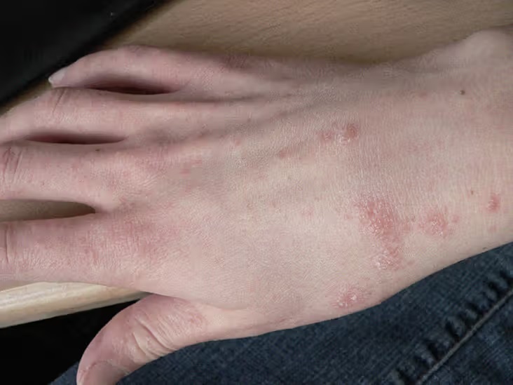 Dau hieu nhan biet ban dang bi ghe hinh anh