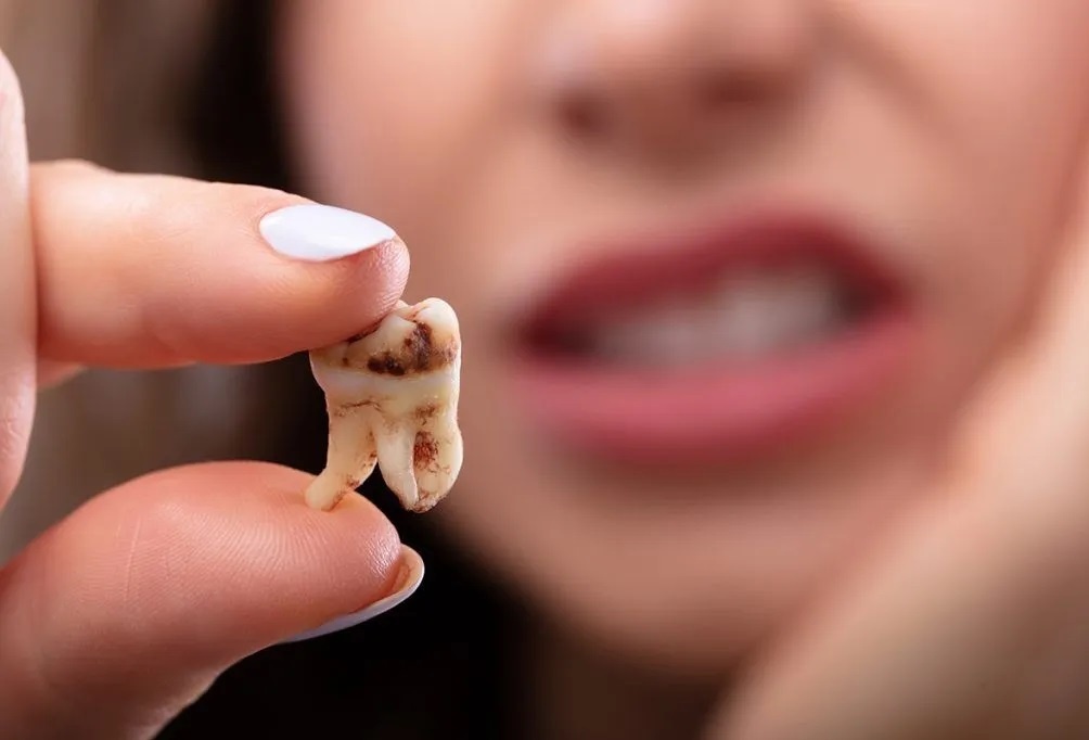 Nhung mon an co the gay sau rang hinh anh