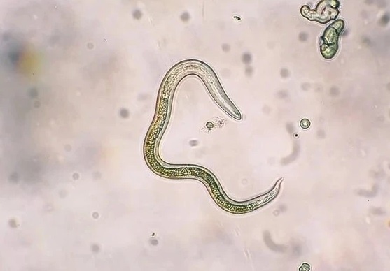 Cach cac loai giun duong ruot lay lan hinh anh