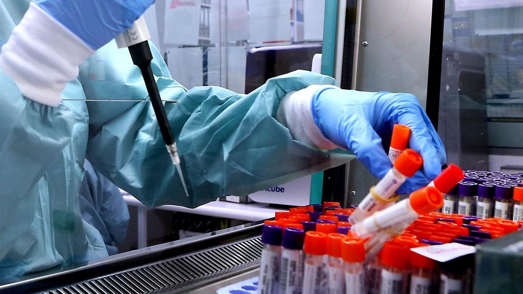 Toan canh vu that lac 300 lo virus nguy hiem chet nguoi o Australia hinh anh