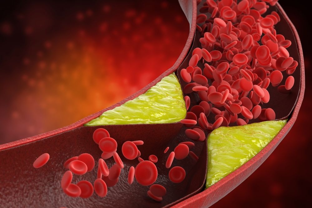 Nhung nguoi de bi mo mau nhat hinh anh