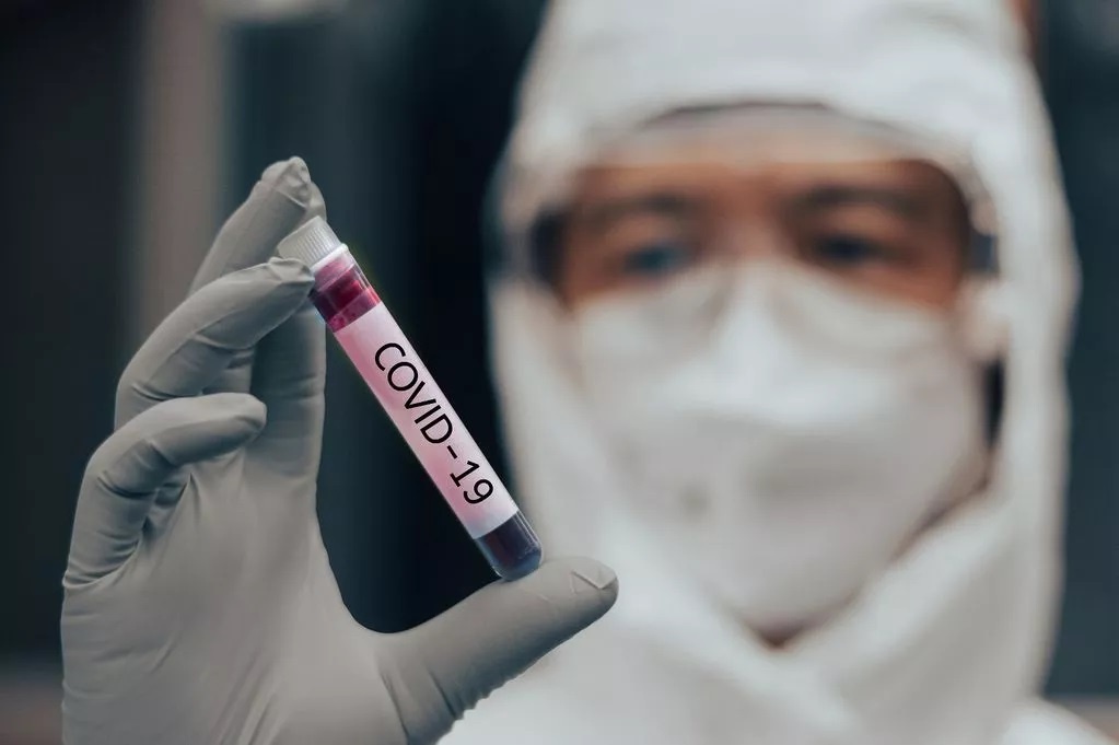 So nguoi khong qua khoi do Covid-19 van chua duoc thong ke hinh anh