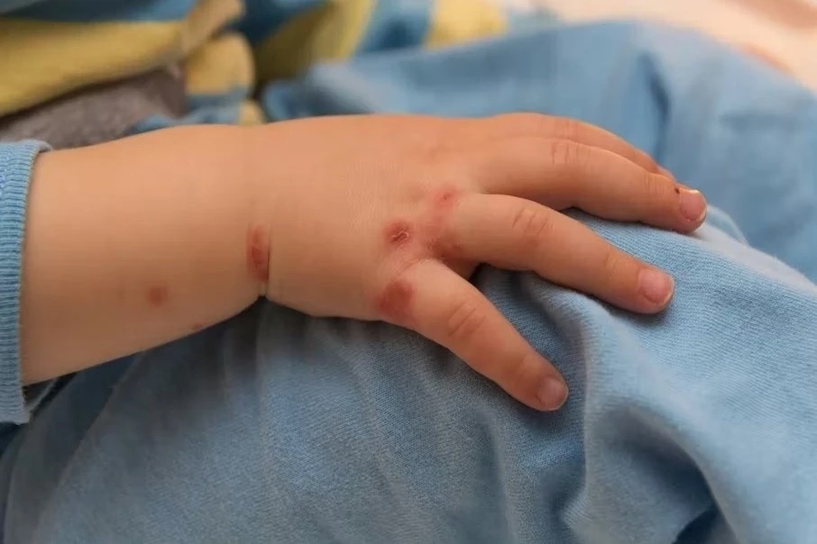 Ban co the mac thuy dau 2 lan? hinh anh