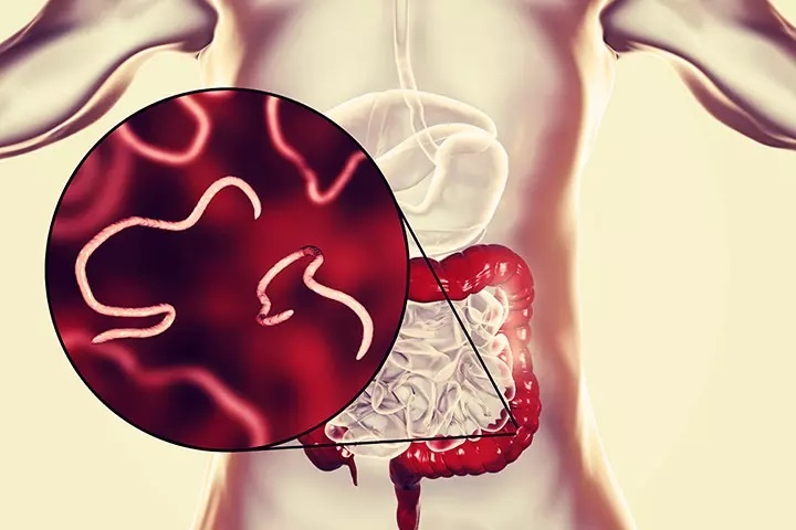 Dau hieu nhan biet ban da nhiem giun kim hinh anh