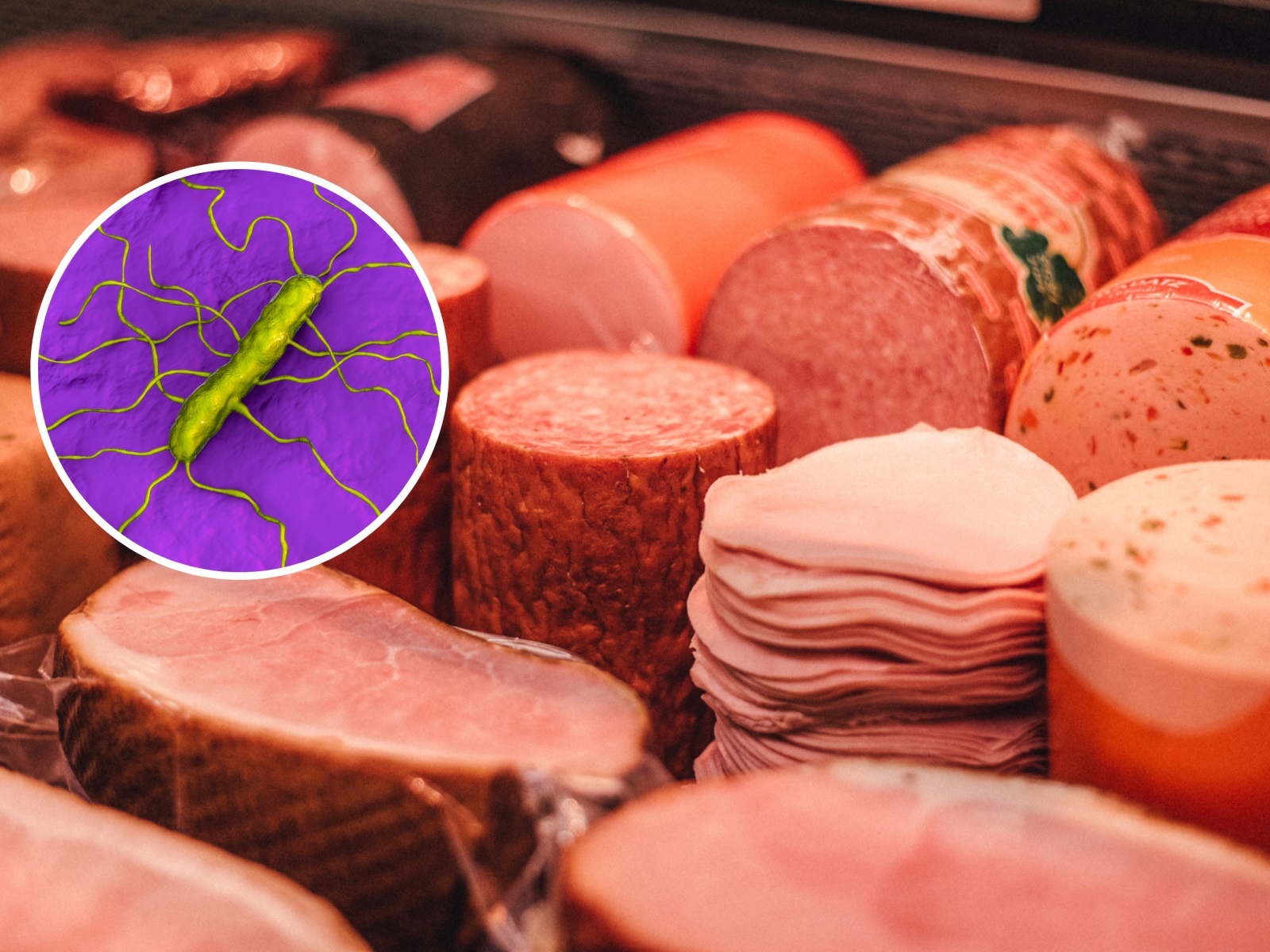 Loai vi khuan de nhiem khi an thit nguoi, sua chua tiet trung hinh anh