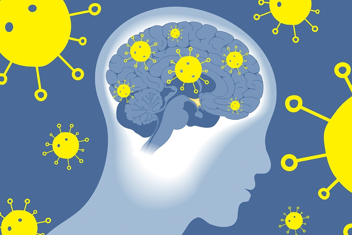 Nghien cuu moi: Dai dich Covid-19 lam tang toc do lao hoa cua nao hinh anh