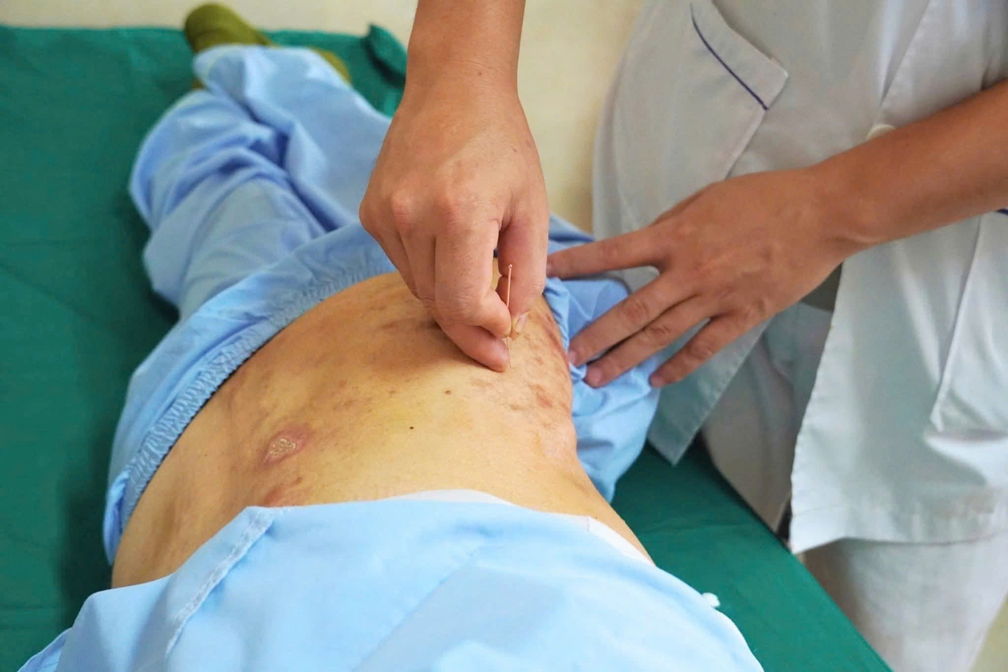 Dau giat tung dot do bien chung cua mot benh quen thuoc hinh anh