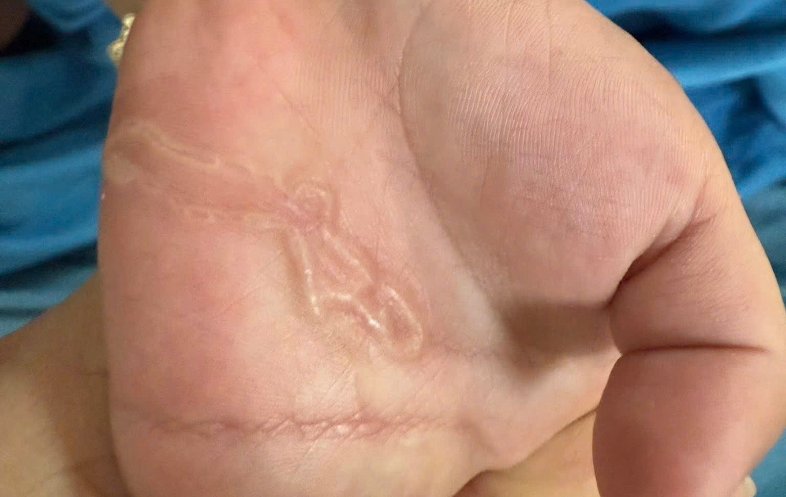 San ky sinh, noi ngoan ngoeo duoi da be trai hinh anh