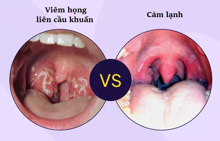 Dau hieu cam lanh anh 1