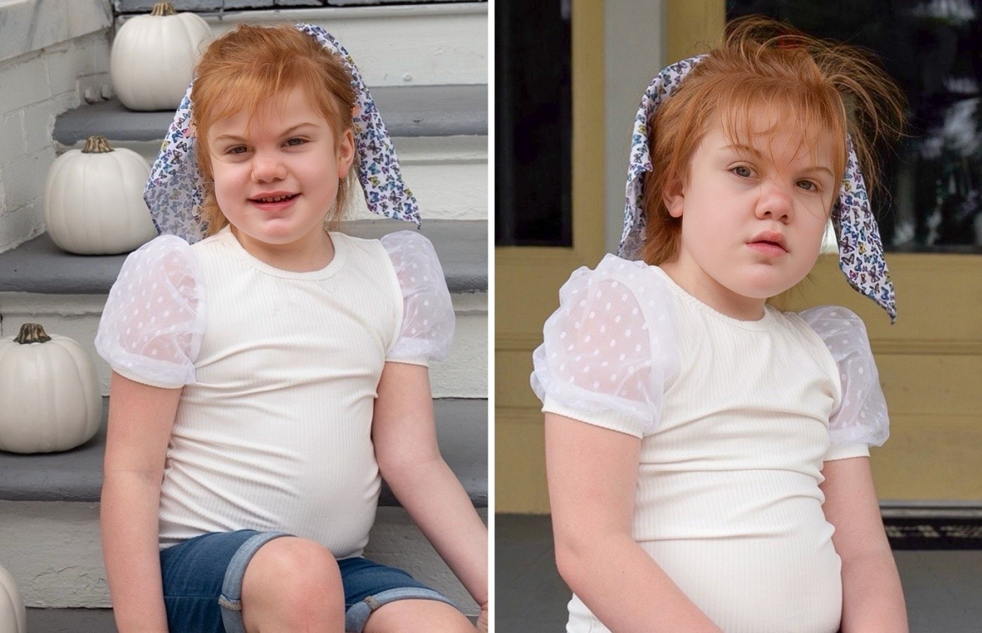 Be gai khat nuoc du doi, sau do phat hien chan doan dau long hinh anh