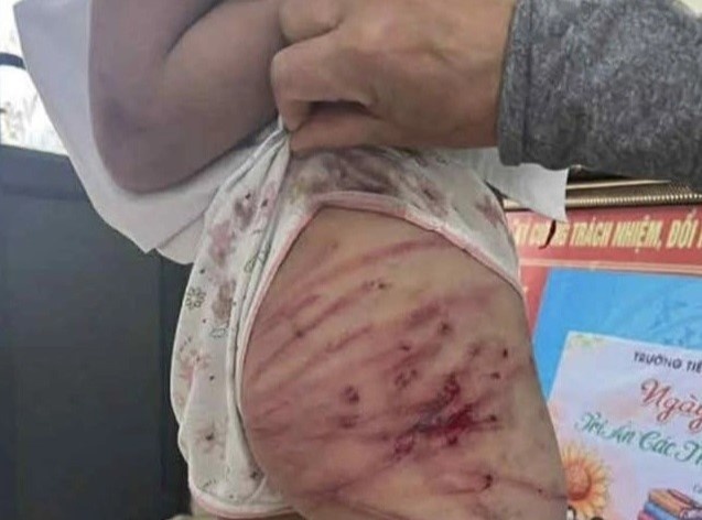 Hanh vi bao hanh tre em se bi xu ly nhu the nao? hinh anh