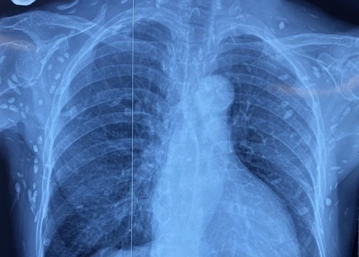 6 loai ky sinh trung gay nguy hiem o nguoi hinh anh