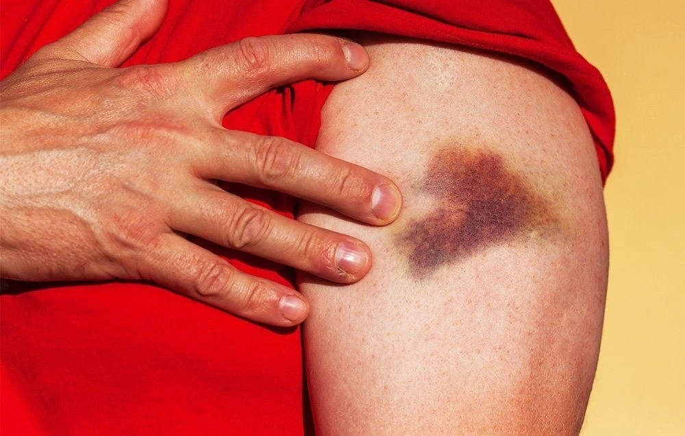 Dau hieu benh tieu duong bieu hien tren da hinh anh