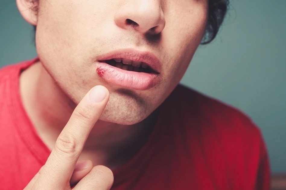 8 dau hieu benh gan xuat hien ngay tren mat hinh anh