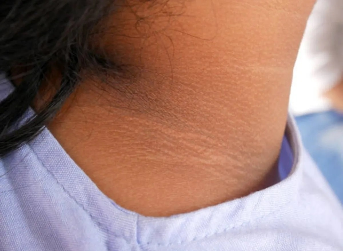 Dau hieu benh gan anh 8