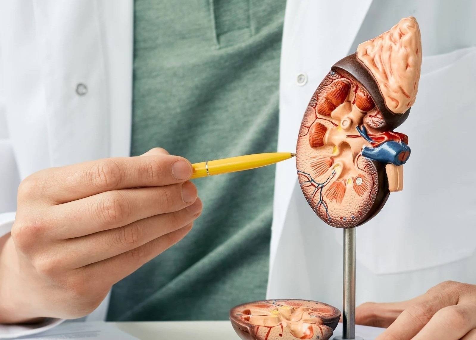 Van de ve than anh 1