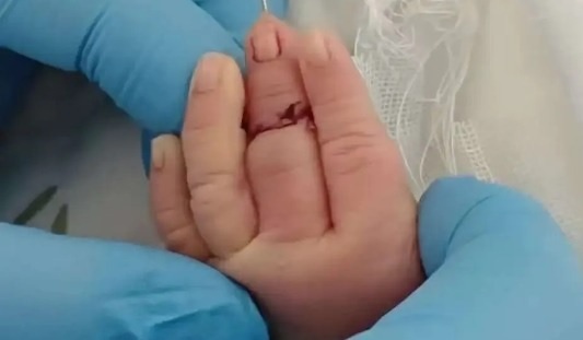 Tre bi dut ngon tay anh 1