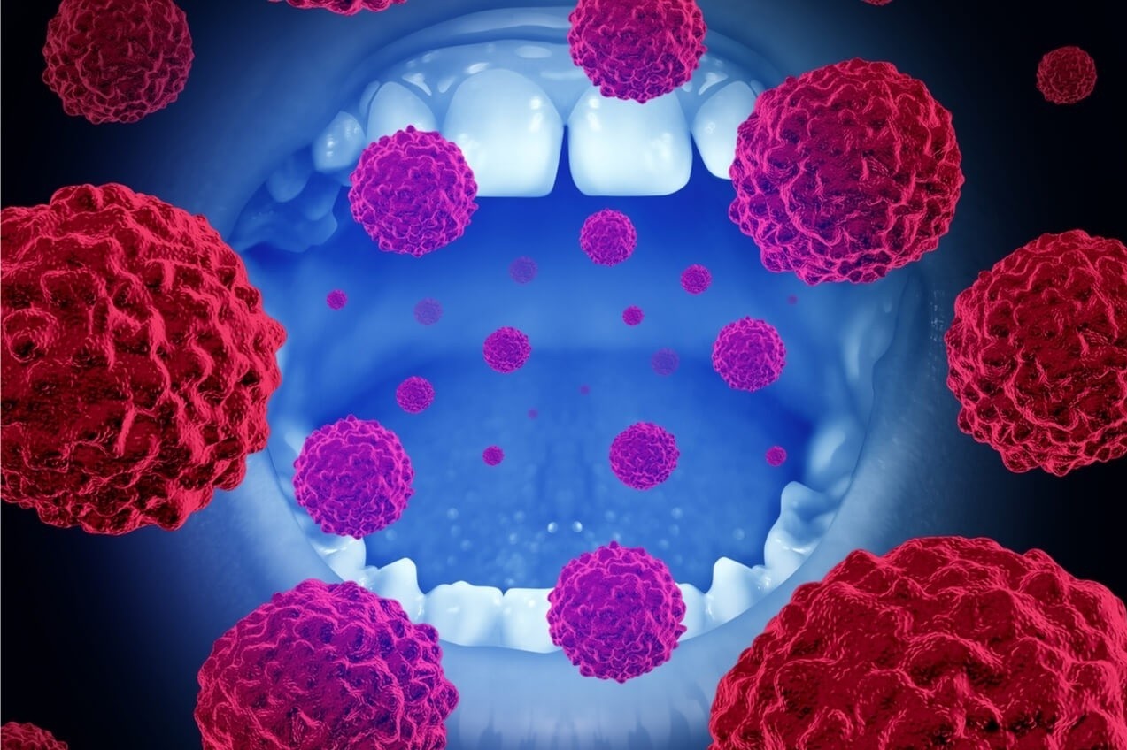 Thoi quen am tham 'nuoi duong' ung thu mieng hinh anh