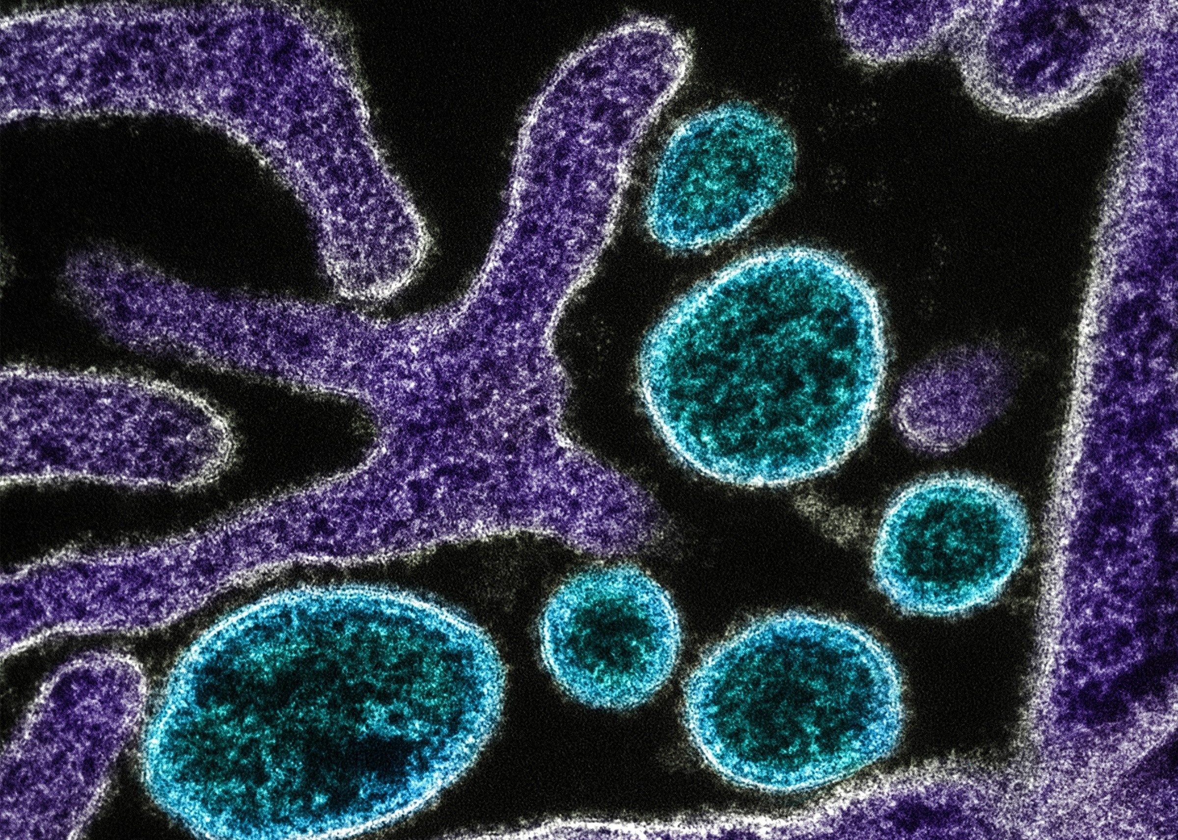 WHO xac nhan ca tu vong do virus Nipah hinh anh