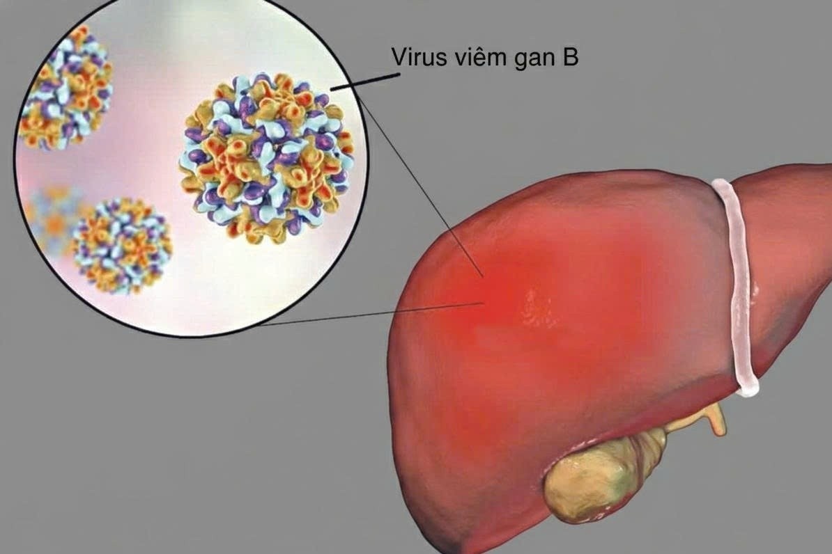 Nhung yeu to rat gay hai cho gan hinh anh