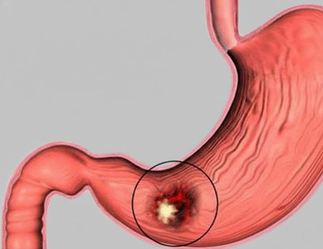 viem loet da day anh 1