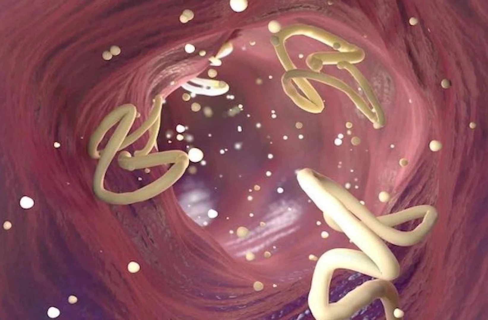 Vi sao can tay giun dinh ky? hinh anh