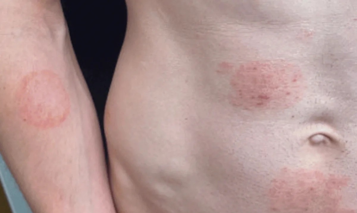 Nam ngoai da TMVII anh 1