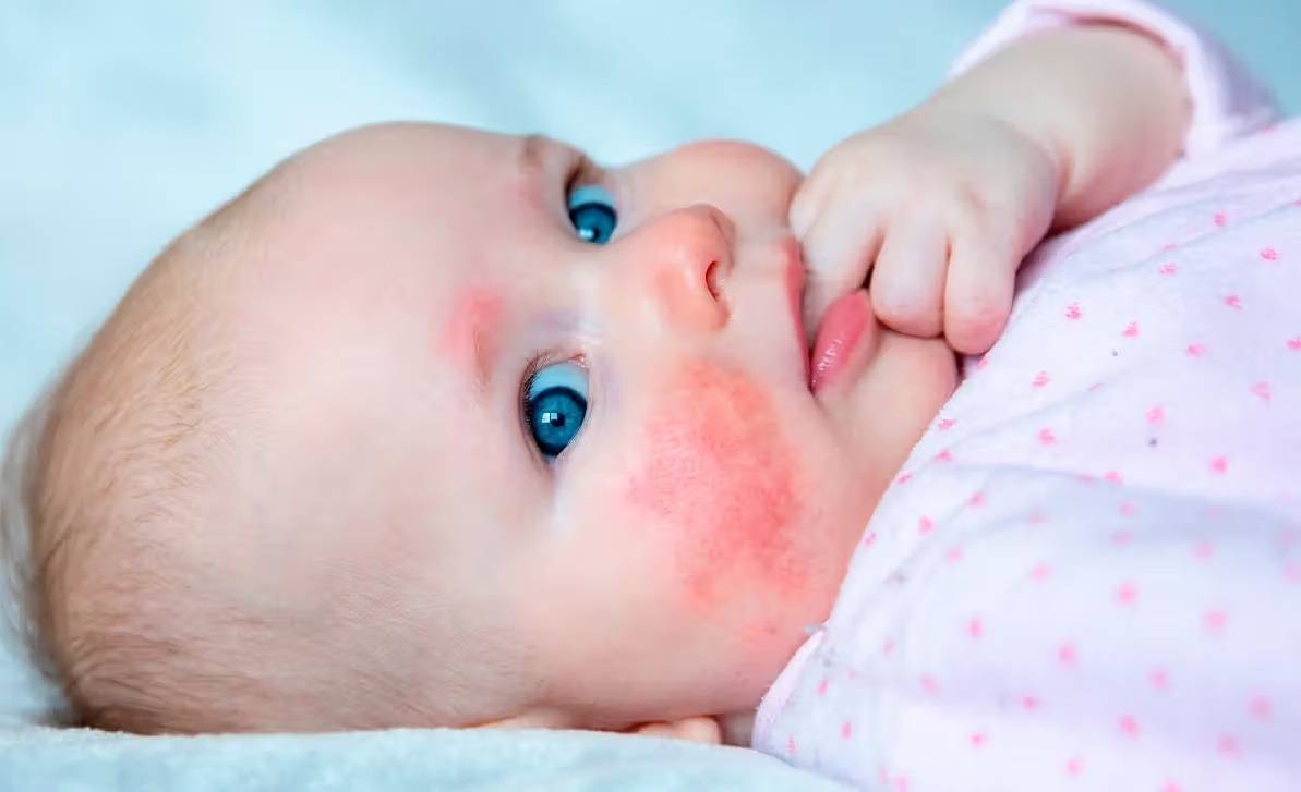 Di ung dam sua bo anh 1