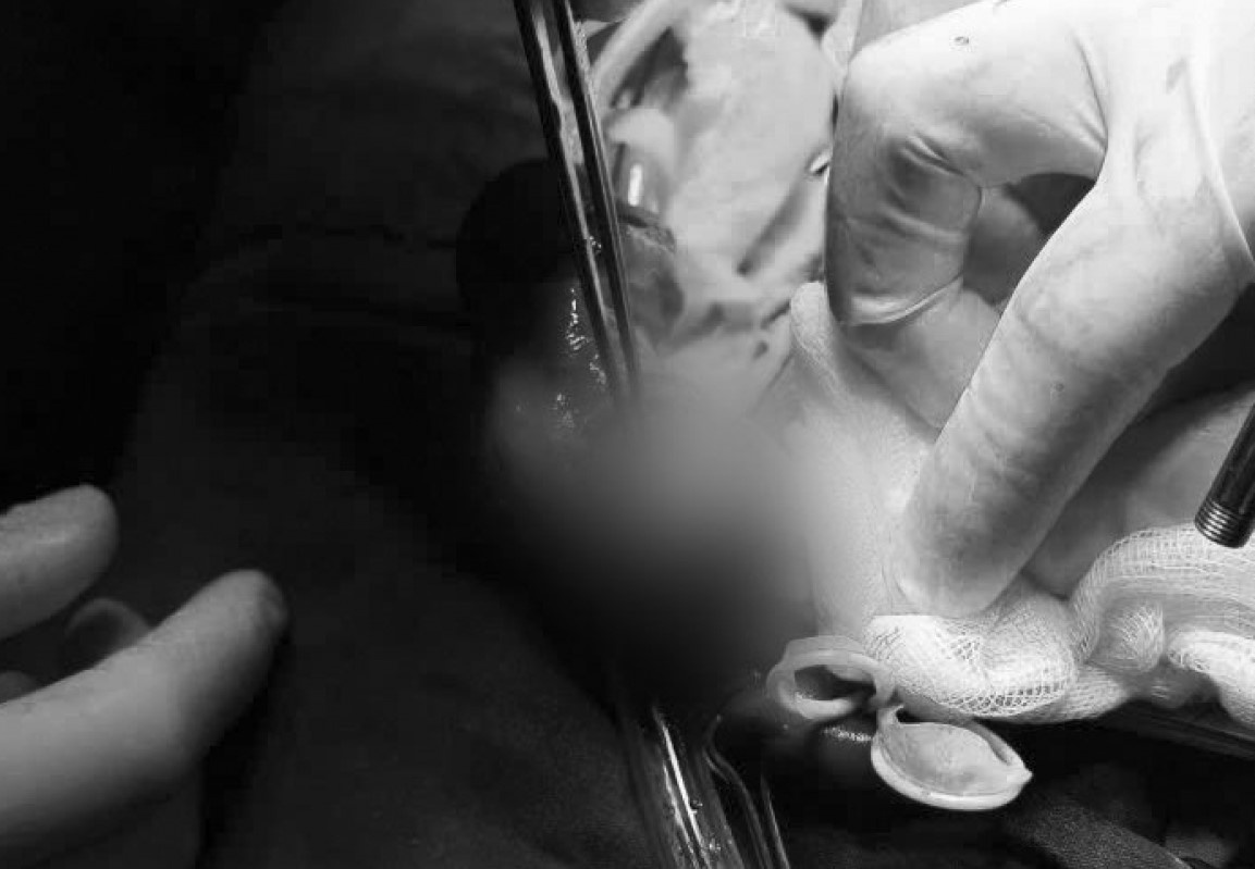 Can thiep khan cap ca tai bien nam khoa nghiem trong hinh anh