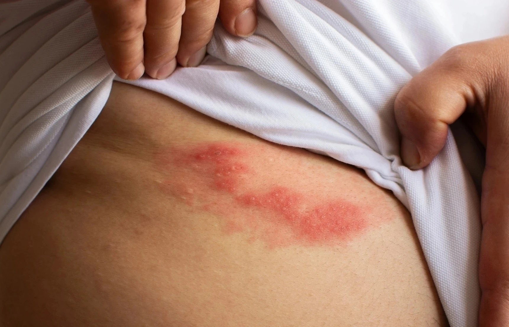 Con dau do zona than kinh du doi den muc nao? hinh anh