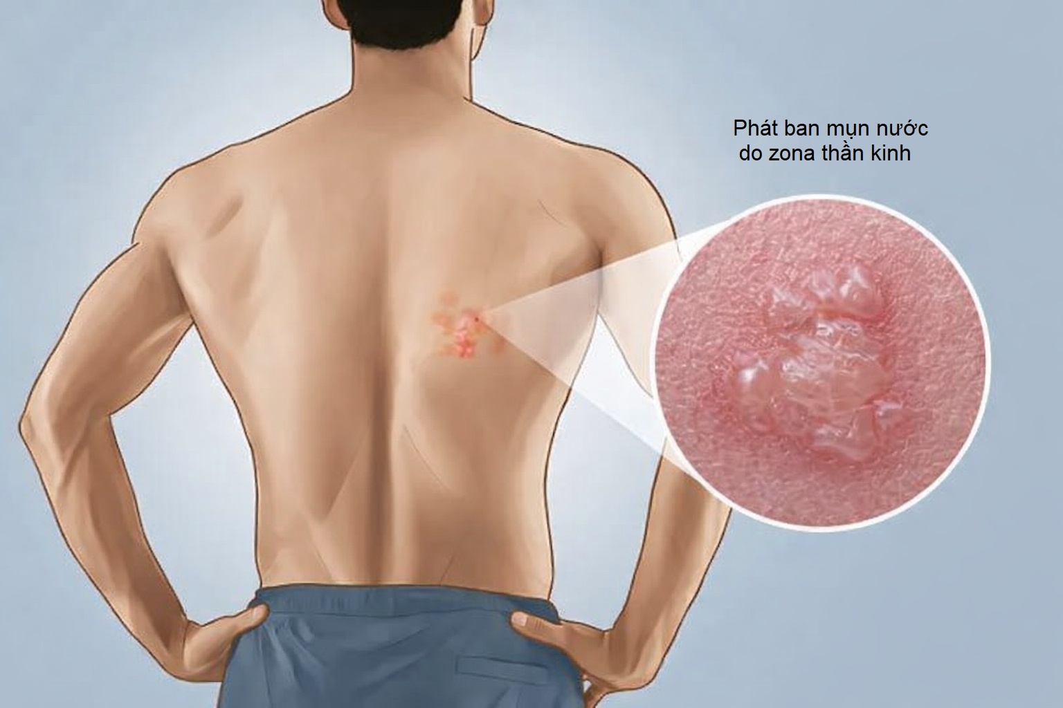 Zona than kinh anh 1