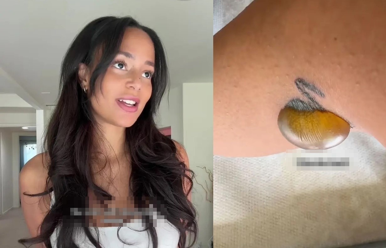 Nu KOL hoang so 'cau cuu' sau khi xoa hinh xam hinh anh