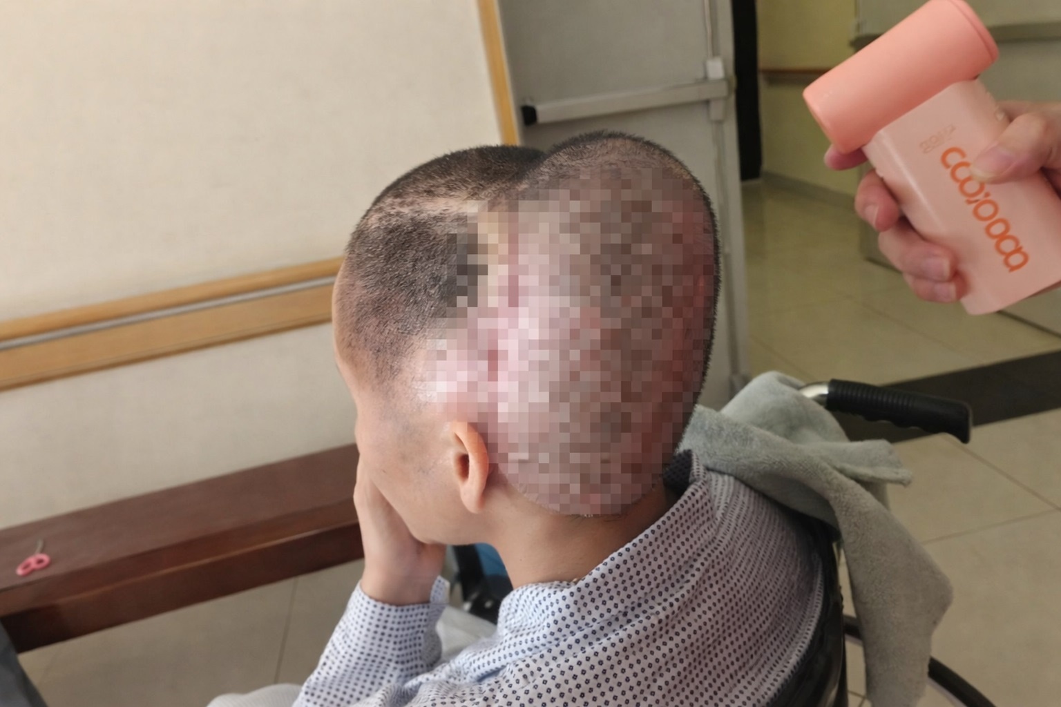 Co gai dot quy, bien dang dau sau khi cay mo tu than hinh anh