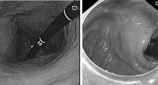 Nhung thoi quen 'tiep tay' cho ung thu da day hinh anh