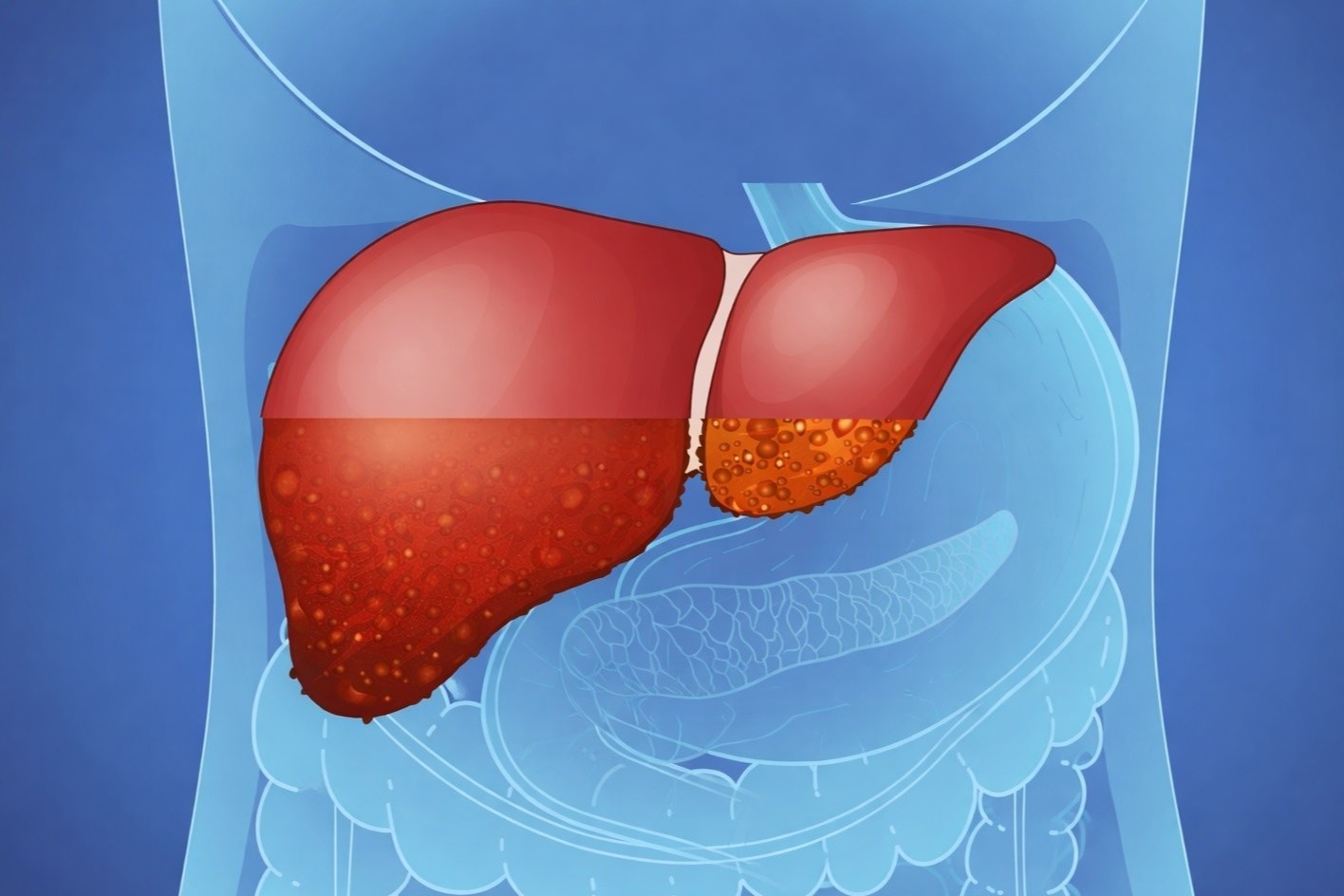 Thoi quen hai gan anh 1