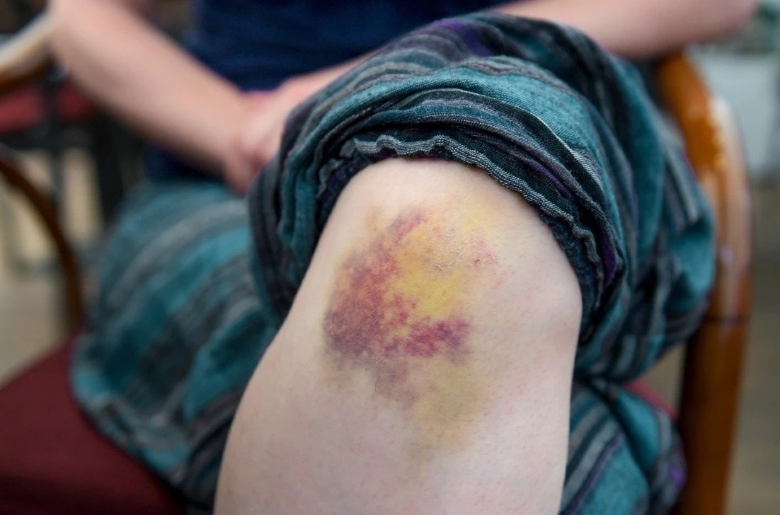 Dau hieu mo mau anh 6