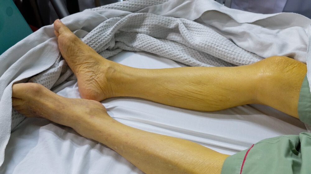 7 thay doi 'nguy hiem' canh bao nguoi mac benh gan hinh anh