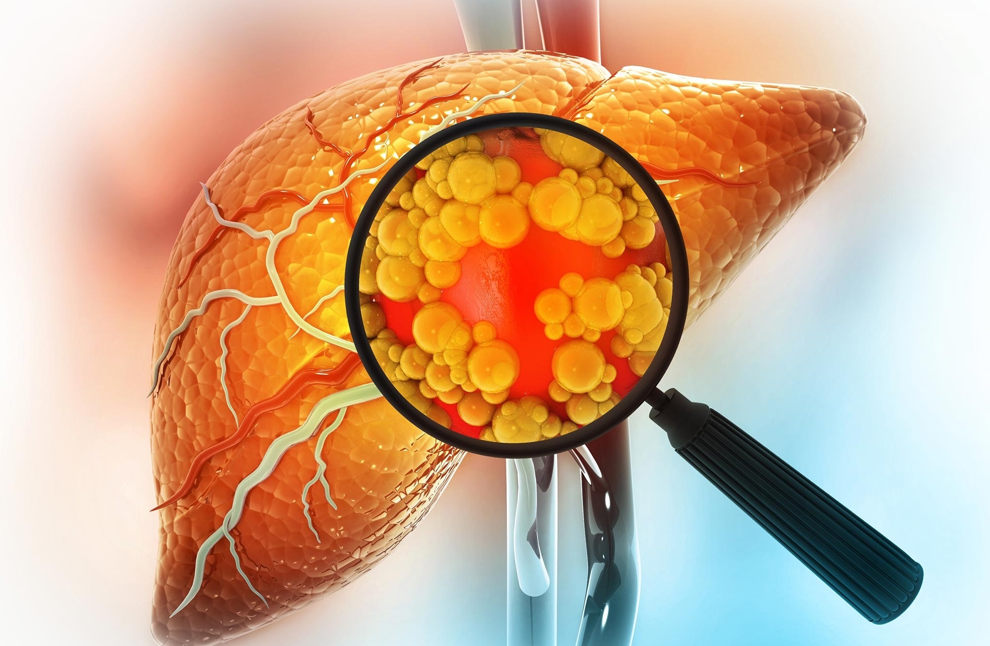 Thoi quen hai gan anh 1