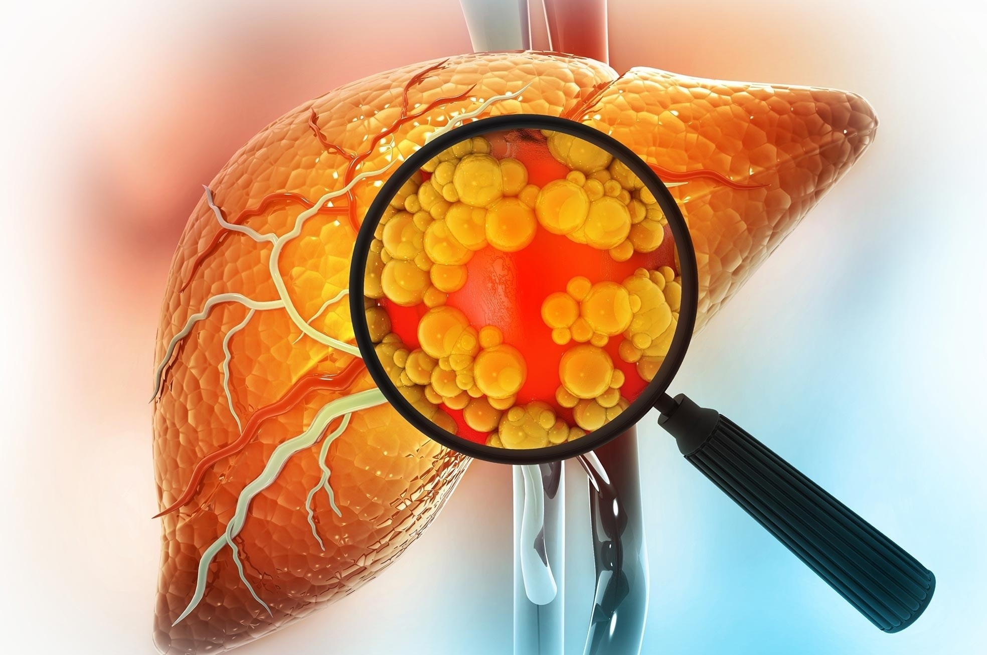 4 thoi quen tan pha la gan 'mot chin mot muoi' voi ruou bia hinh anh