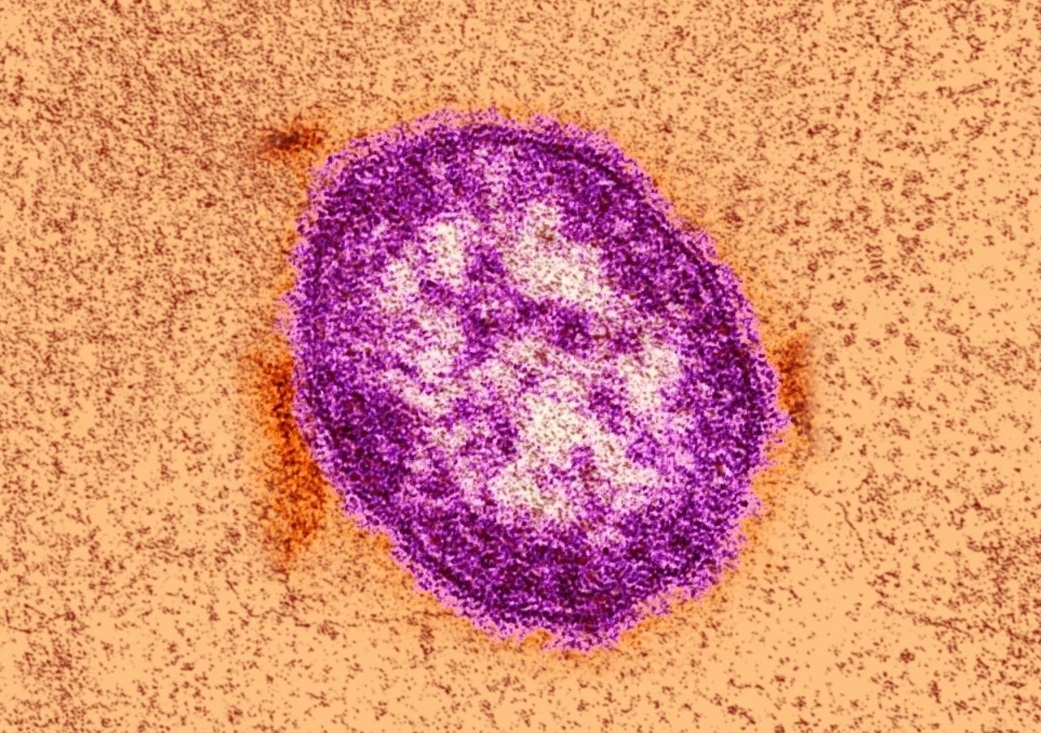 Benh soi anh 1