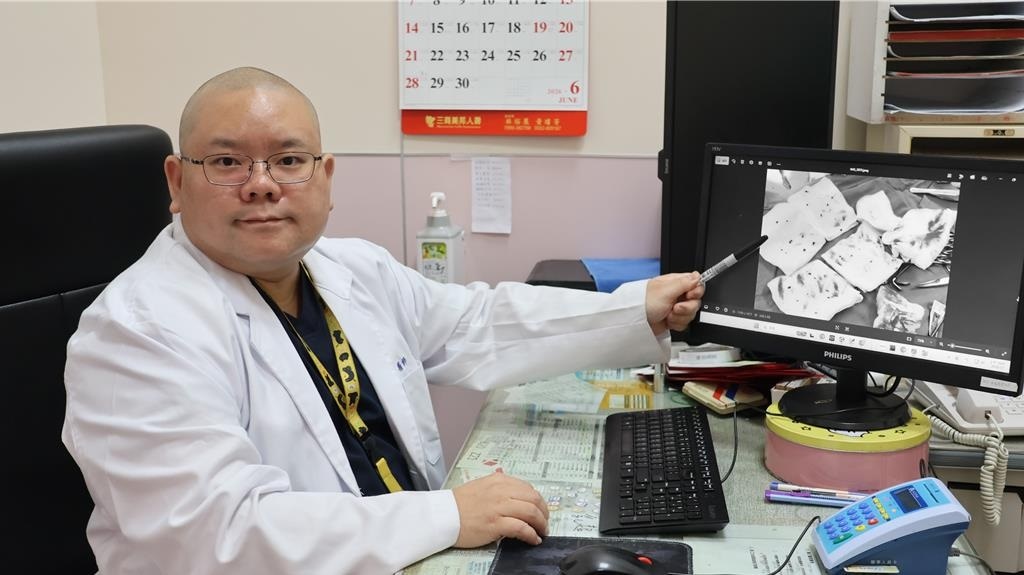 Sui mao ga anh 1