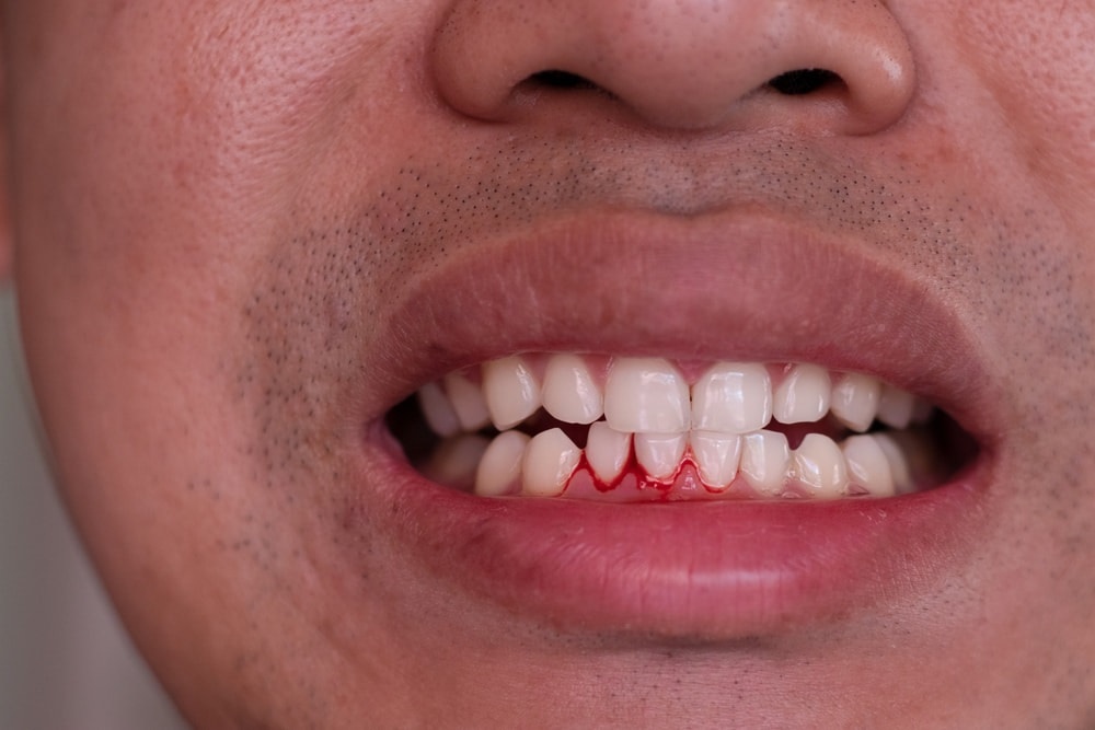 4 dấu hiệu gan đang 'kêu cứu' biểu hiện trên mặt