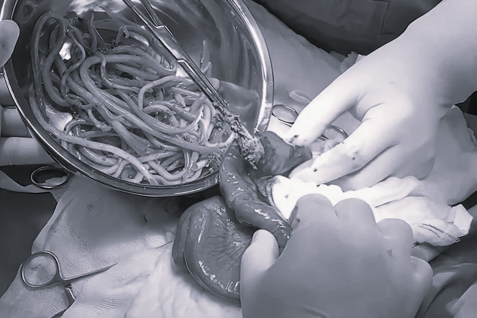 Nhóm người tuyệt đối không được quên tẩy giun