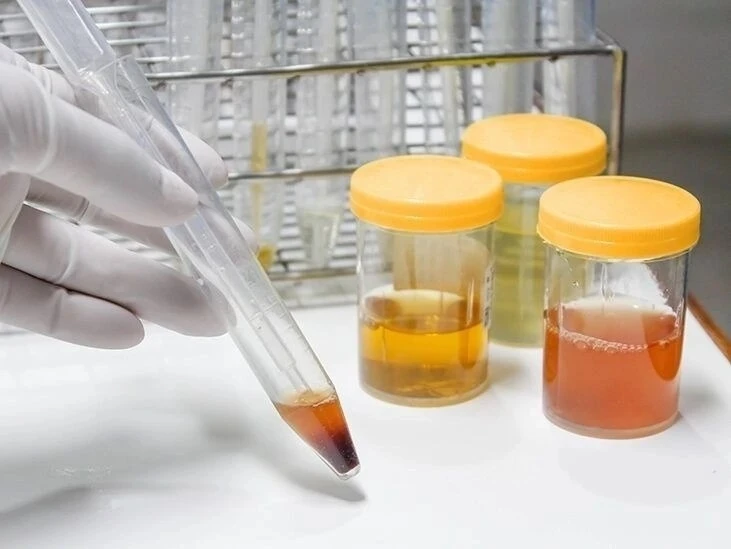 Người c&oacute; thận khỏe ảnh 2