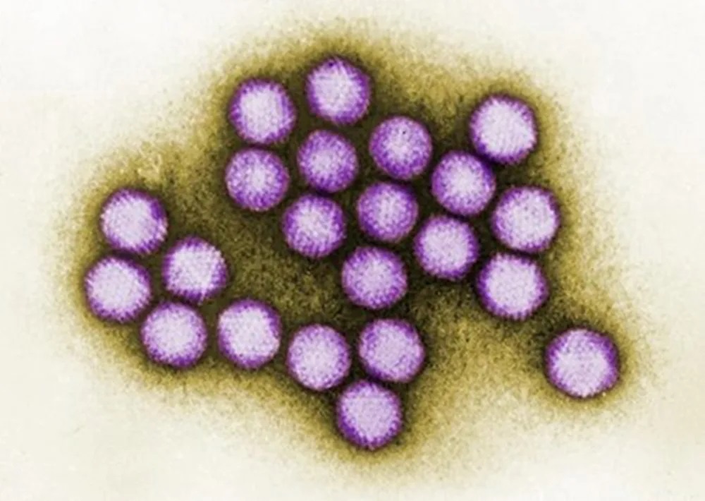 Virus Adeno là gì? 6 dấu hiệu cảnh báo không nên chủ quan