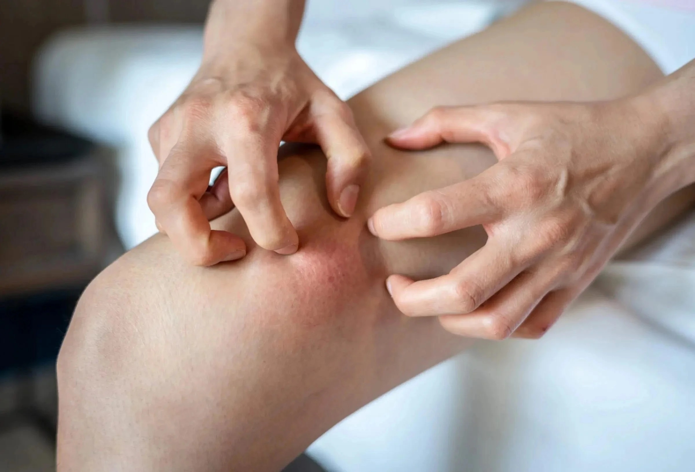 Dấu hiệu gan tổn thương ảnh 2