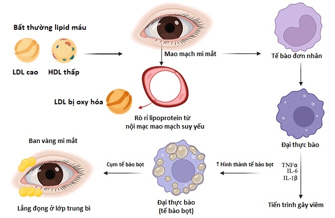 Đột quỵ ảnh 2