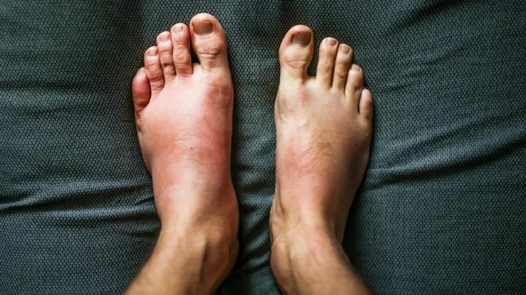 Bất thường khi ngủ ảnh 2