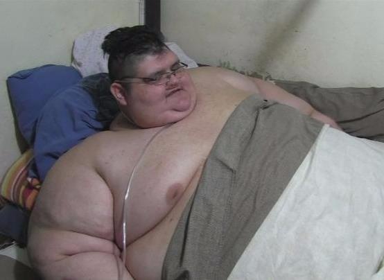 Chang trai Mexico beo nhat the gioi tim cach giu mang song hinh anh