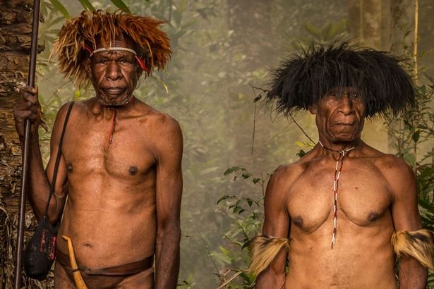 bo lac Dani chat ngon tay anh 4